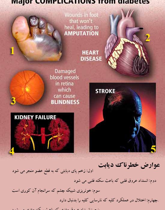 عوارض دیابت