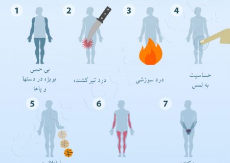 نشانه های نوروپاتی محیطی