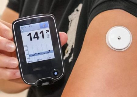 CGM از نوع اسکن متناوب، کنترل گلوکز را در دیابت نوع ۱ بهبود می بخشد