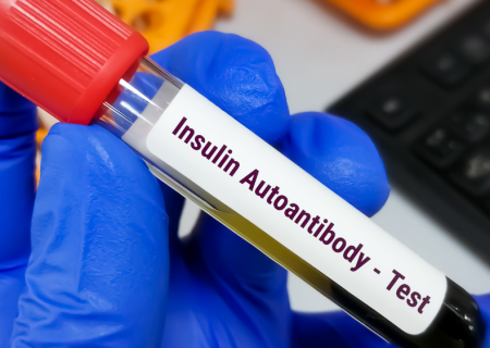 افزایش شواهد مبنی بر اینکه سیستم ایمنی ممکن است منشاء دیابت نوع ۱ نباشد