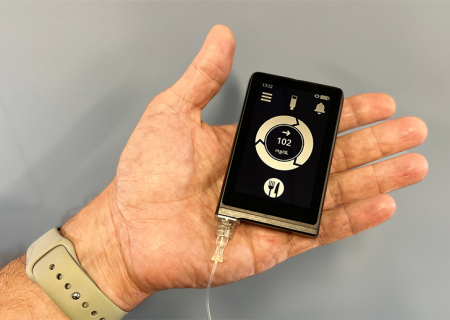 لوزالمعده مصنوعی مدیریت دیابت نوع ۱ را ساده می‌کند.