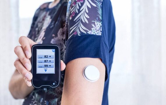 تحقیقات نشان می دهد که پایش مداوم گلوکز، زندگی افراد مبتلا به دیابت نوع ۱ را تغییر می دهد