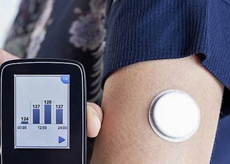 CGM سطح HbA۱c را در T۱D (دیابت نوع یک) بهبود می‌بخشد.