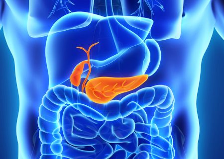 پیوند جزایر پانکراس پس از پیوند کلیه در دیابت نوع ۱ مفید است