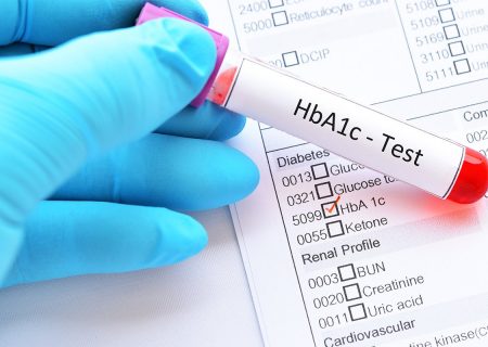 چه کسانی باید برای پیش دیابت یا دیابت غربالگری شوند؟