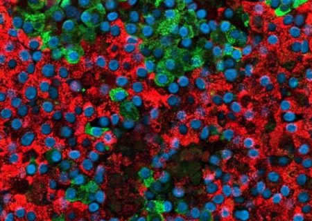 مطالعات از فعال شدن مجدد سلول های شبه بتا در پانکراس برای تولید انسولین خبر می دهد