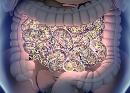 تفاوت میکروبیوم روده در دوران نوزادی می تواند دیابت نوع ۱ را پیش بینی کند